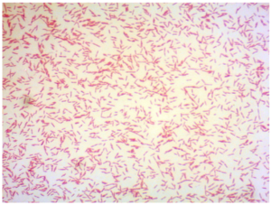 Capnocytophaga